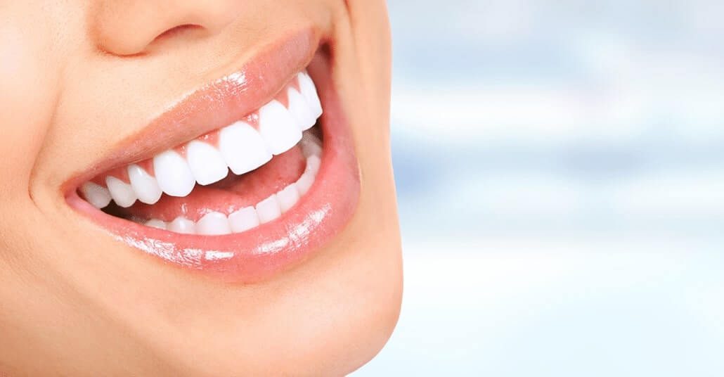 Smile Makeover In Turkey, Hollywood Smile Design Costs