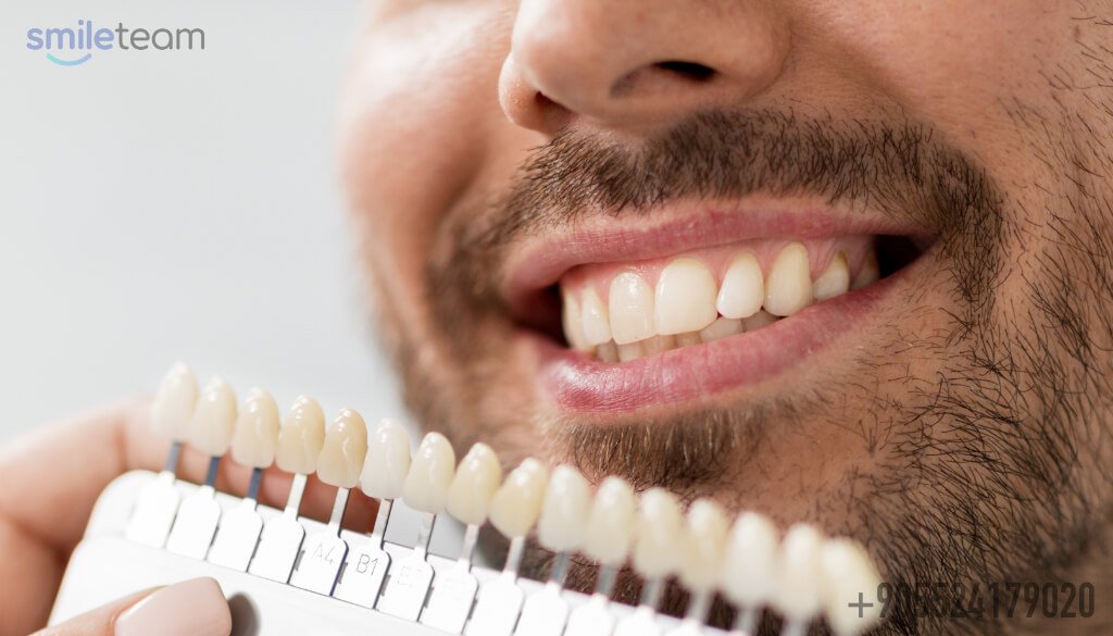 Full Set of Veneers and Crowns- Dental Clinic Turkey