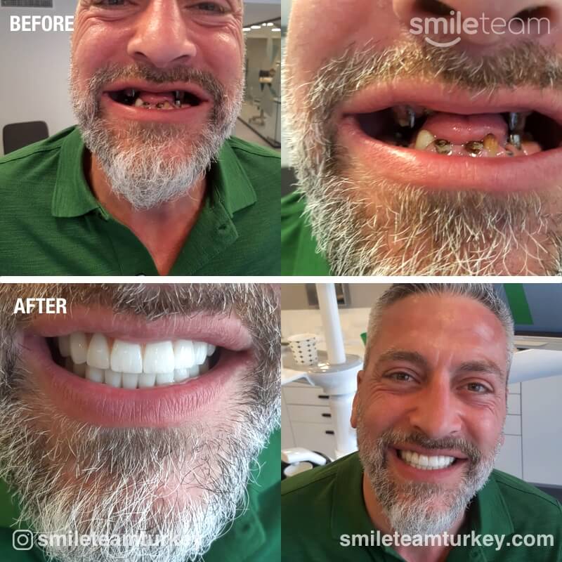 dental patient reviews before after