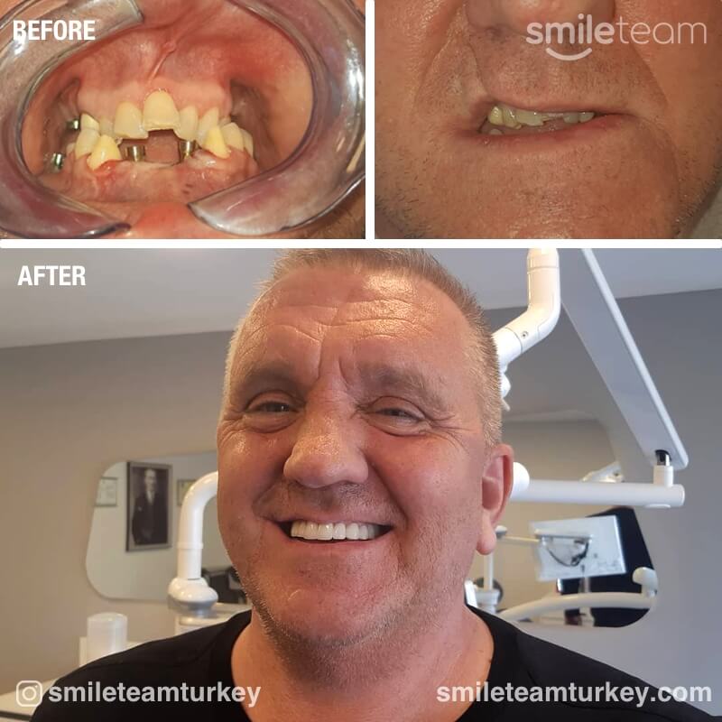 dental patient reviews before after