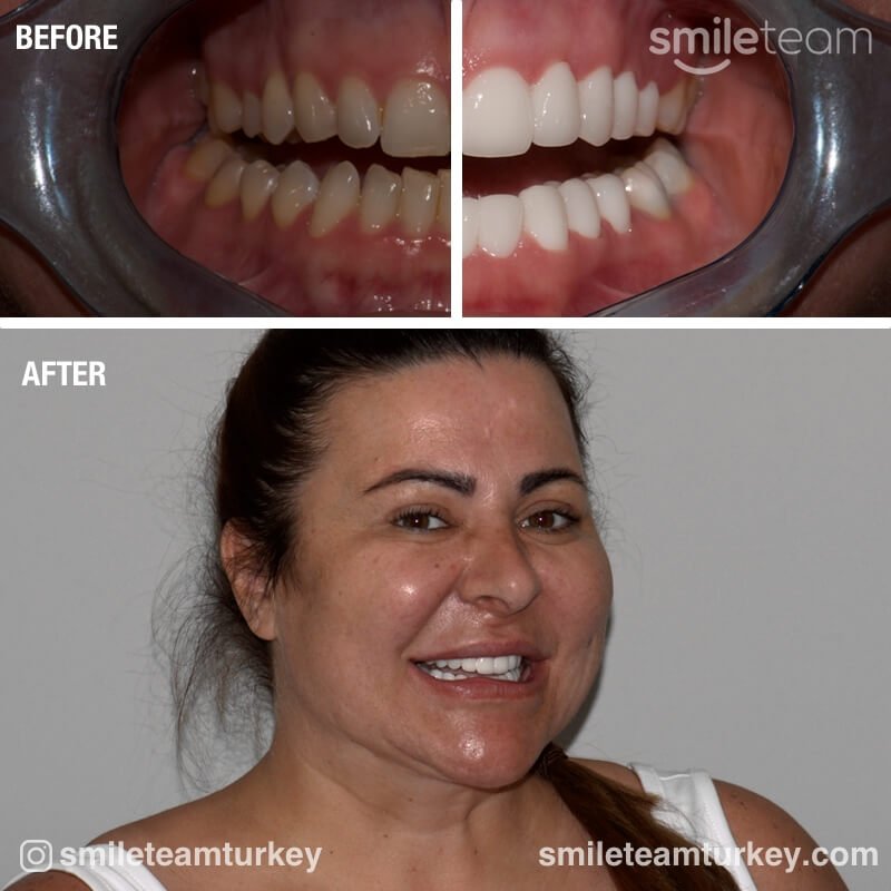 dental patient reviews before after