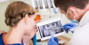 How Long does Full Mouth Dental Implants Take?