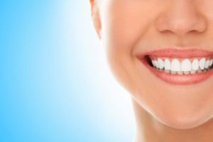How Much do All-on-4 Dental Implants Cost in Turkey?