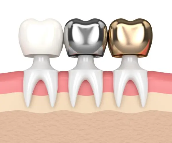 Dental crown materials