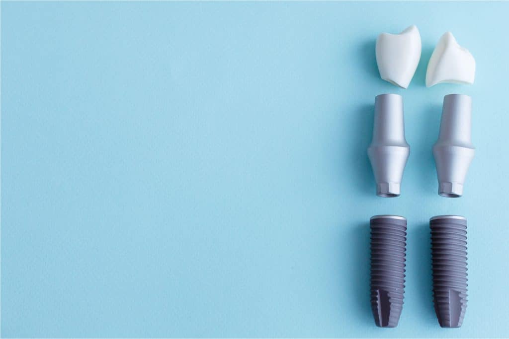 all on 4 vs all on 6 dental implants