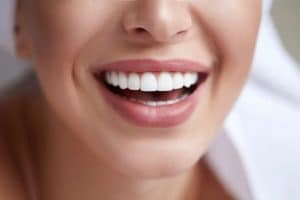 DIFFERENCE BETWEEN VENEERS VS CROWNS