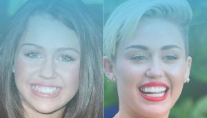 Hollywood Smile of Celebrities: Top Celebrities who received a "Hollywood smile”