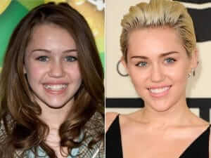 Miley Cyrus' Teeth