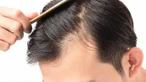 the comparison of fue and fut hair transplant