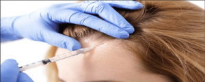 How Many PRP Sessions are Required for Hair to Regrow