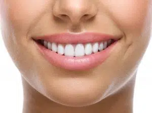 https://smileteamturkey.com/blog/what-is-teeth-straightening/