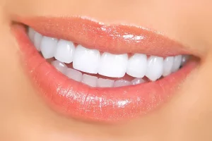 Advantages of Getting Zirconia Crowns