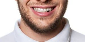 The Leading Causes Of Tooth Loss In Adults - Smile Team Turkey