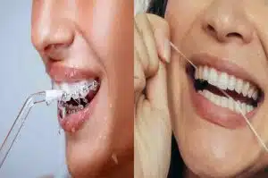 Water Floss vs Dental Floss