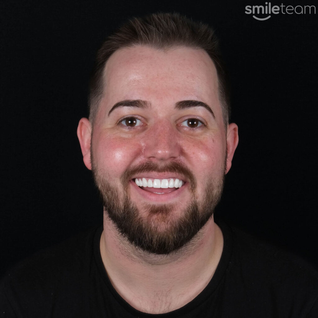 happy man receiving dental treatment in antalya