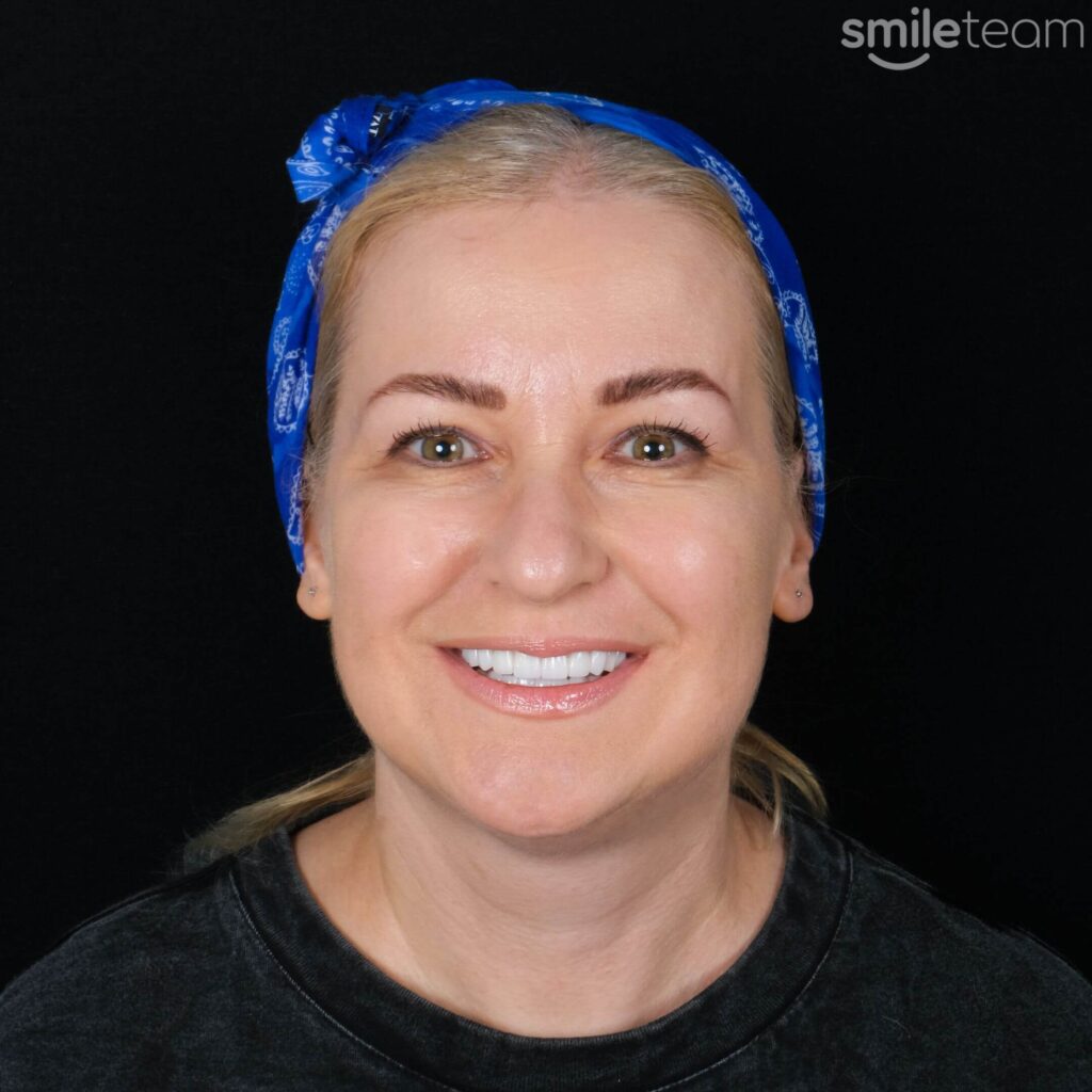 happy patient receiving dental treatment in antalya