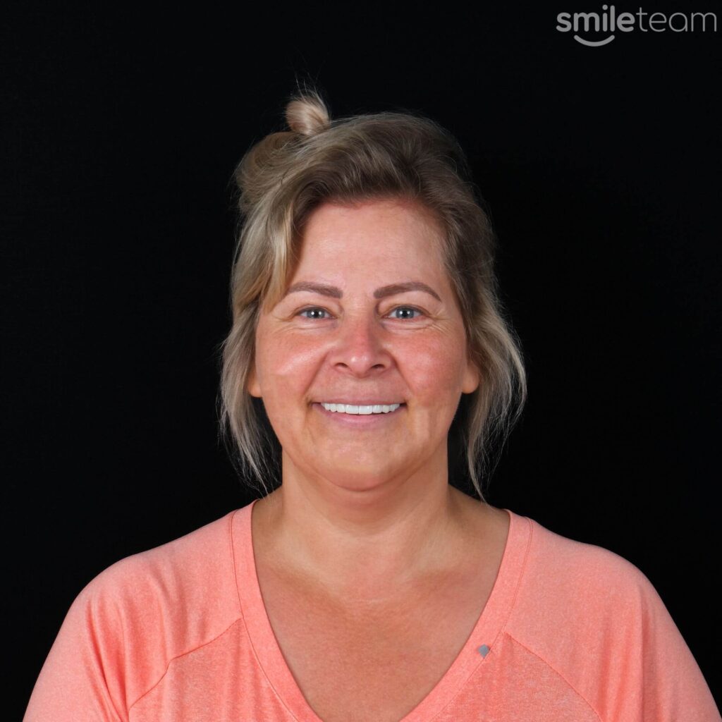 happy patient receiving dental treatment in antalya