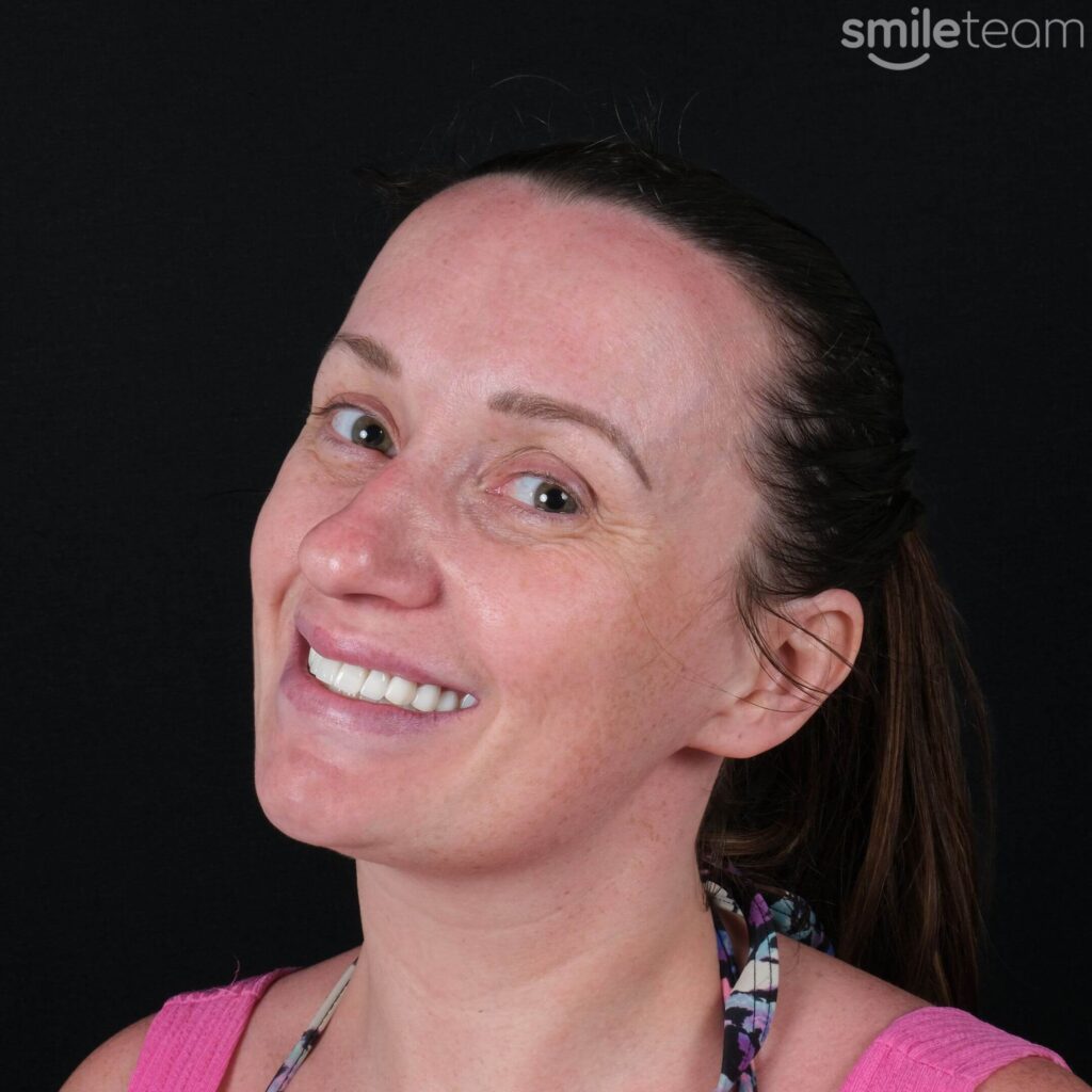 happy patient receiving dental treatment in turkey