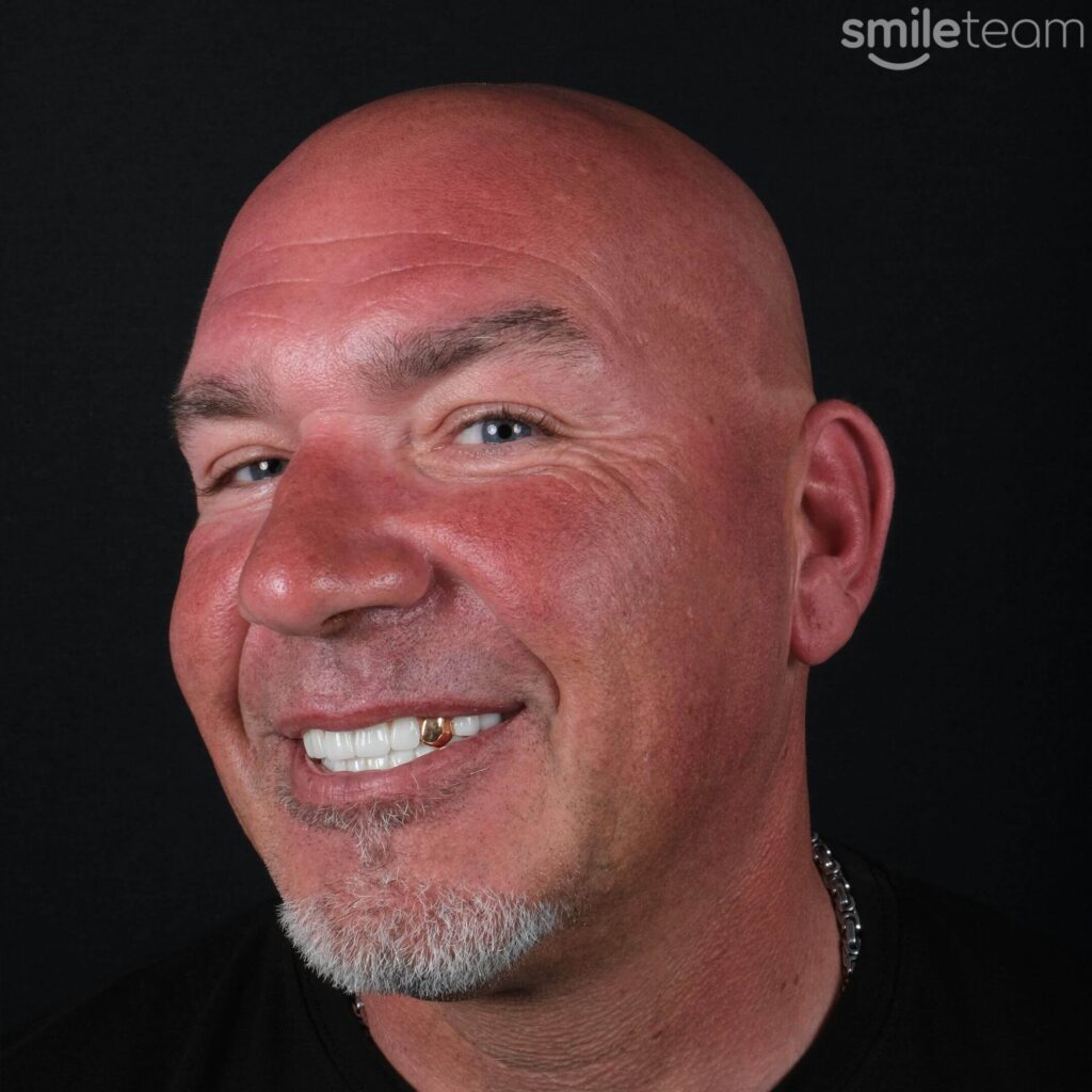 happy patient receiving dental treatment in turkey