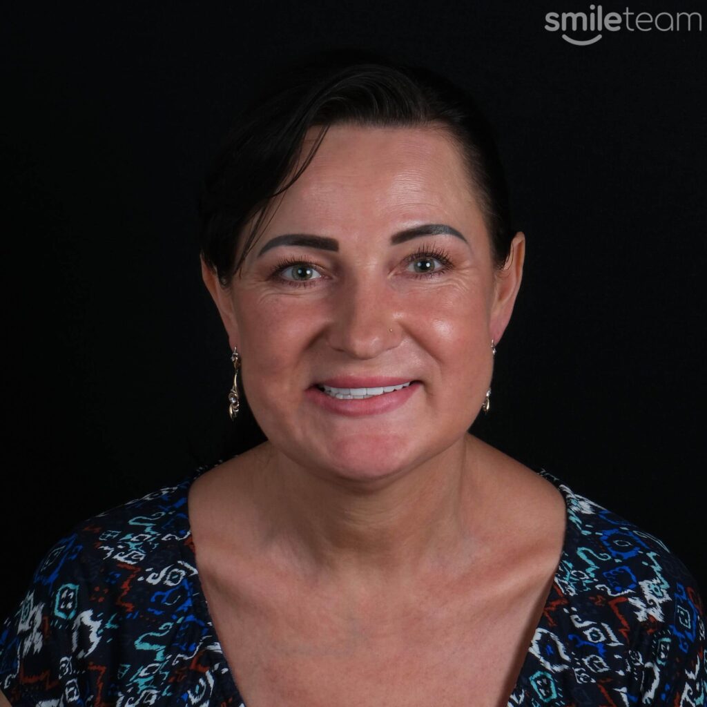 happy patient receiving dental treatment in turkey