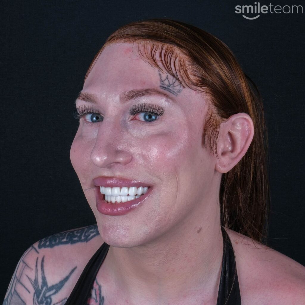 happy patient receiving dental treatment in turkey