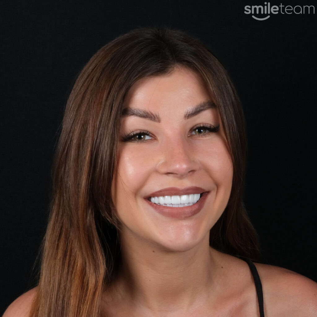 girl receiving dental treatment in turkey